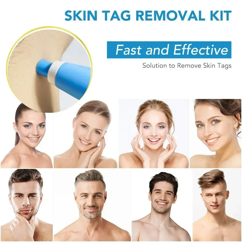 2-in-1 Painless Skin Tag & Mole Removal Kit